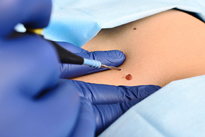 Hautchirurgie